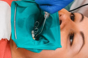 Root Canal Retreatment: What Happens When An Old Treatment Fails?