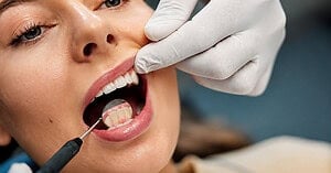 Save On Dental Implants Without Giving Up Quality: Why Patients Choose Endeta Dental Clinic